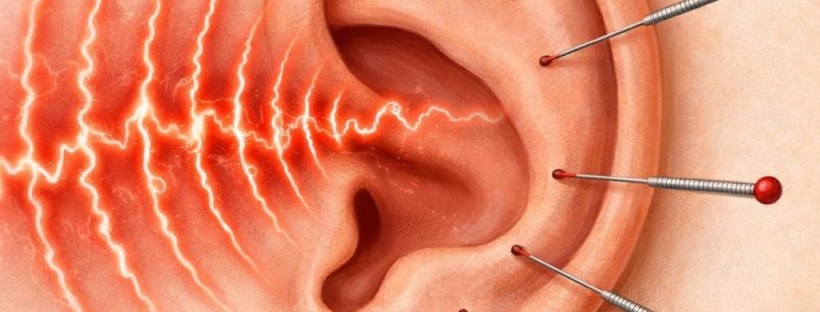 Ear with acupuncture needles inserted and red wave patterns indicating pain or nerve activity